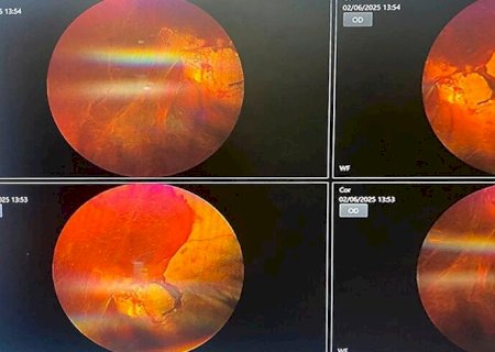 GRÁVIDA E PRESTES A PERDER A VISÃO, MULHER PRECISA DE R$ 10 MIL PARA TRATAMENTO URGENTE NOS OLHOS