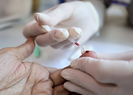 PREFEITURA REFORÇA AÇÕES DE PREVENÇÃO E DIAGNÓSTICO DAS HEPATITES VIRAIS